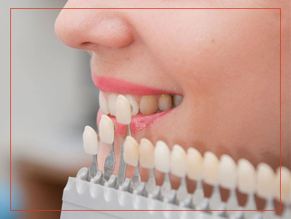 Lentes de Contato Iso Clínica